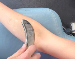 We are taking a curved metal tool and using it to scrape the forearm. The metal tool is being held at an angle, not directly pushing into the skin. this is called muscle scraping